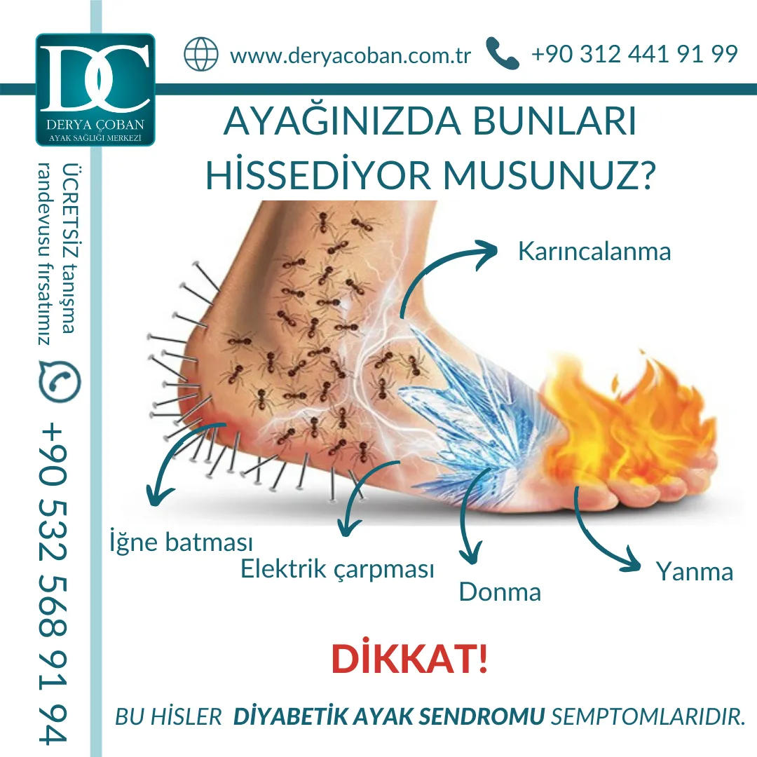 Diyabetik Ayak Sendromu Semptomları