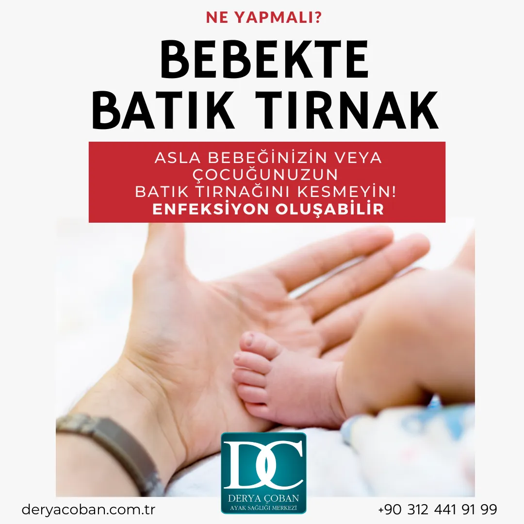 Bebeklerde Batık Tırnak