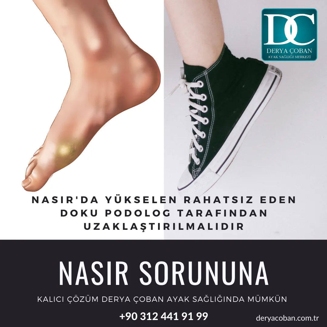 Nasır Nedir? Ne sebep olur?