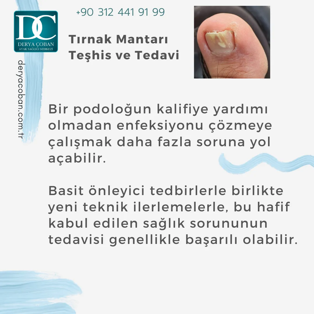 Tırnak Mantarı Nedir? Nasıl Tedavi Edilir? Nasıl Önlenir?