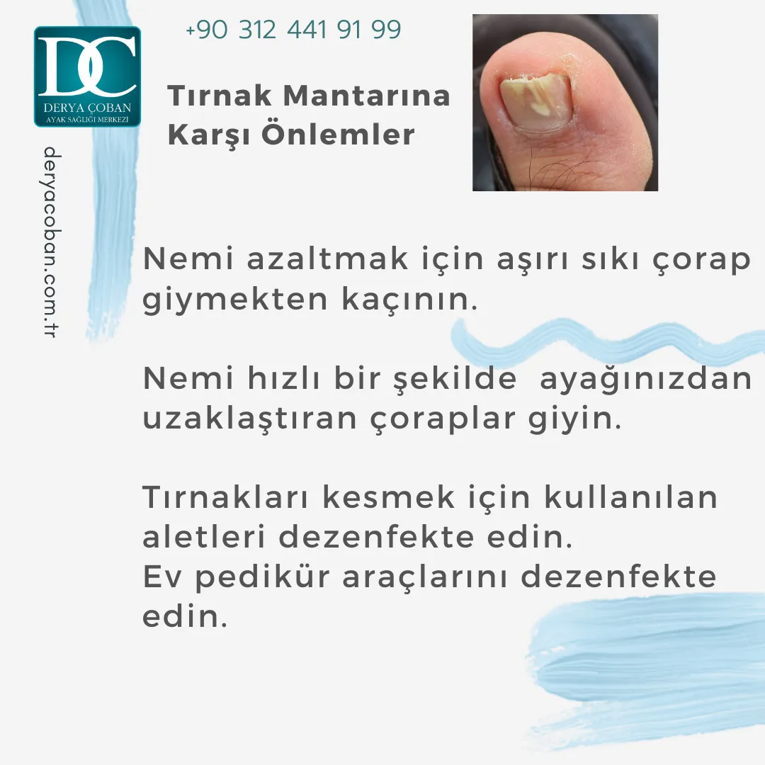 Tırnak Mantarı Nedir? Nasıl Tedavi Edilir? Nasıl Önlenir?
