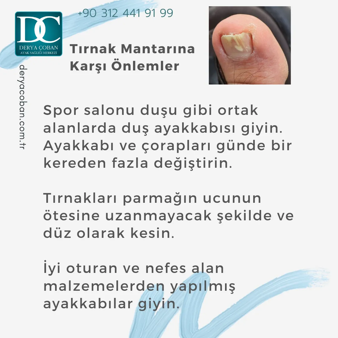 Tırnak Mantarı Nedir? Nasıl Tedavi Edilir? Nasıl Önlenir?