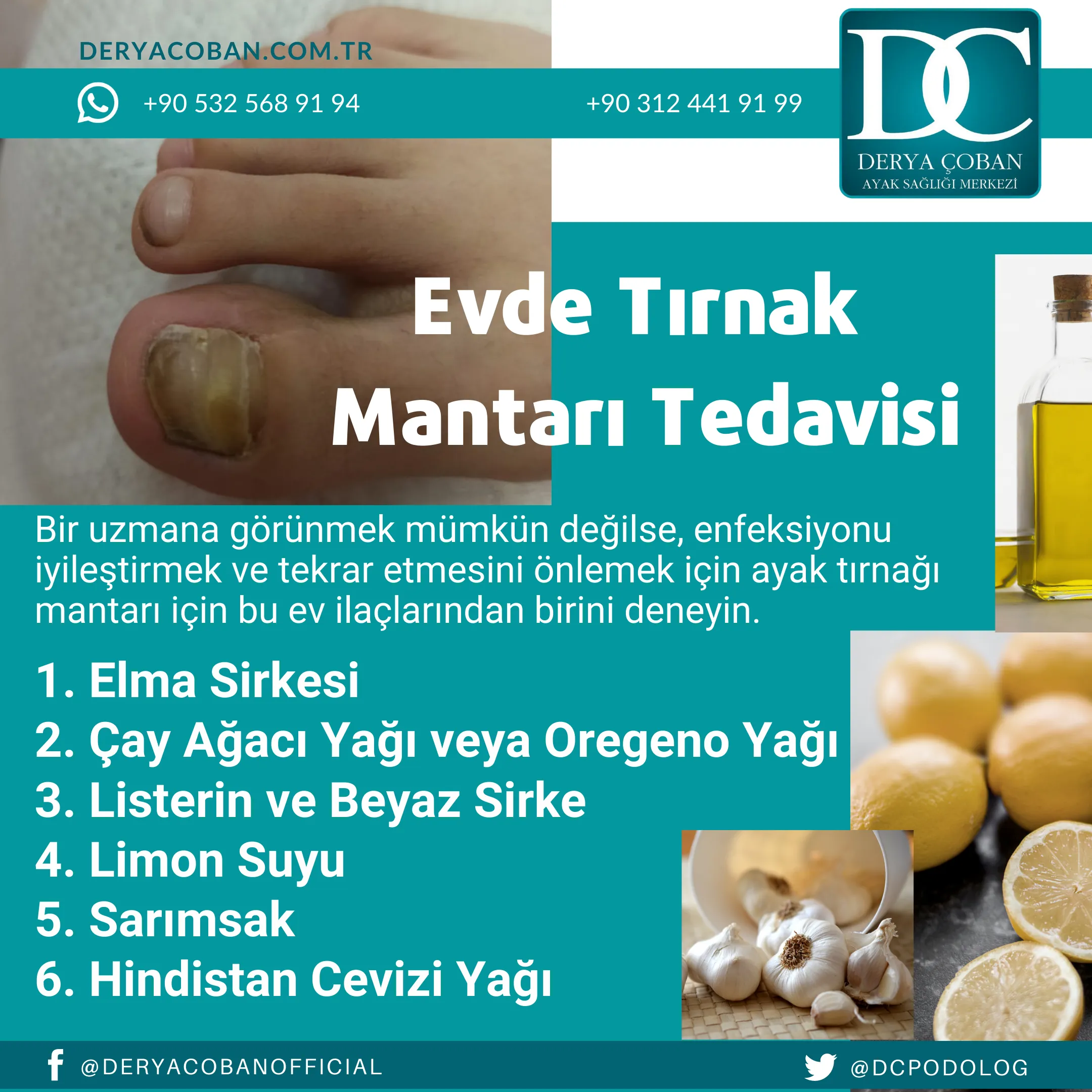 Evde Ayak Tırnak Mantarı Tedavisi