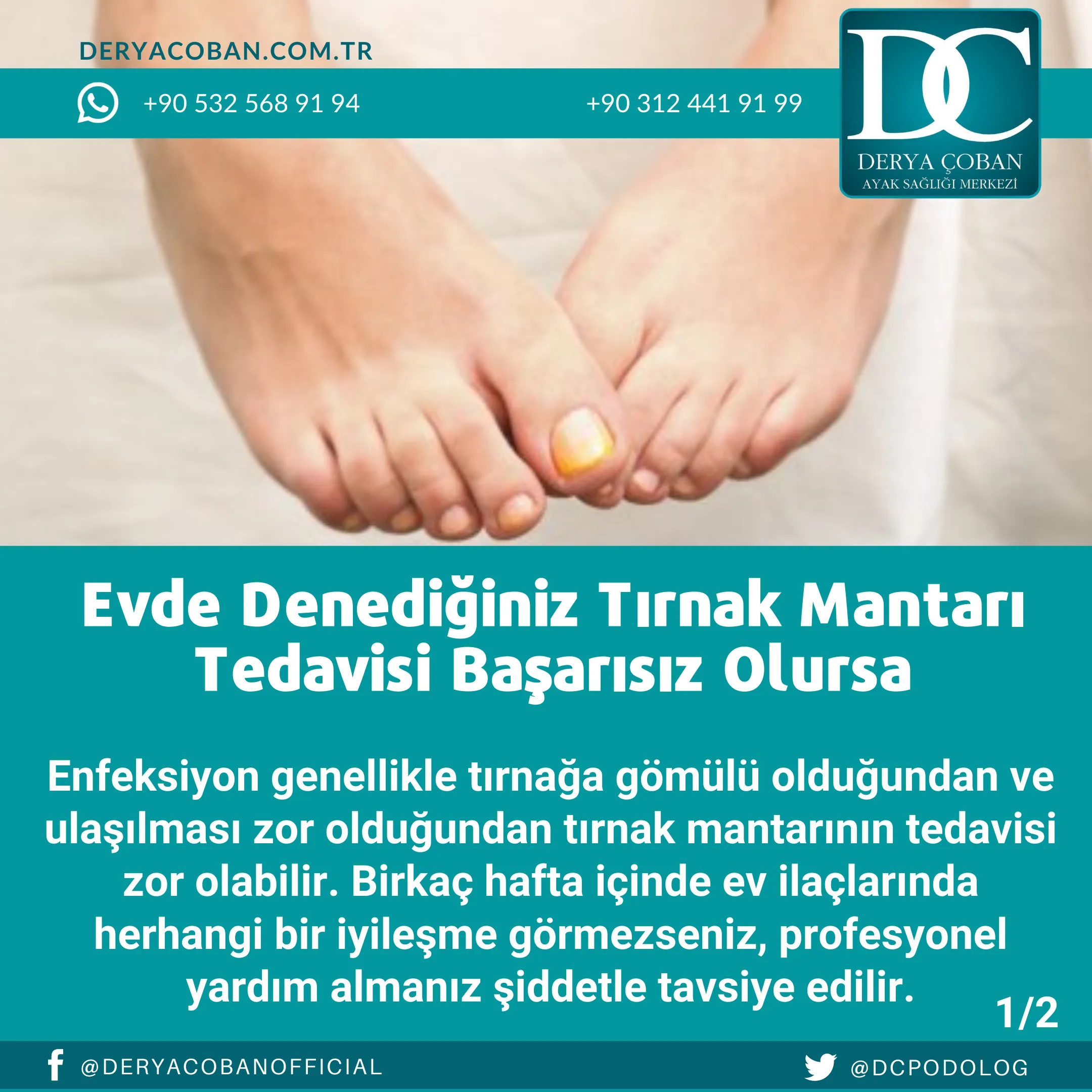 Tırnak Mantarı Nasıl Geçer?