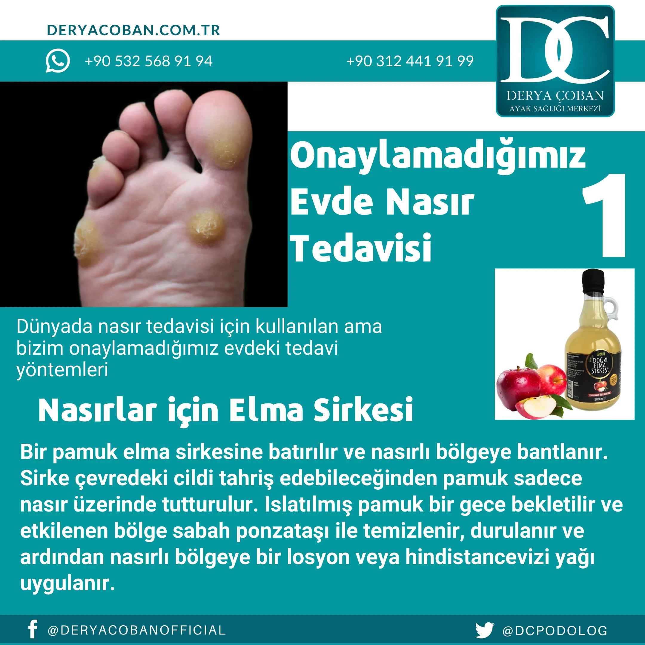 Nasır için Uzak Durulması Gerekenler