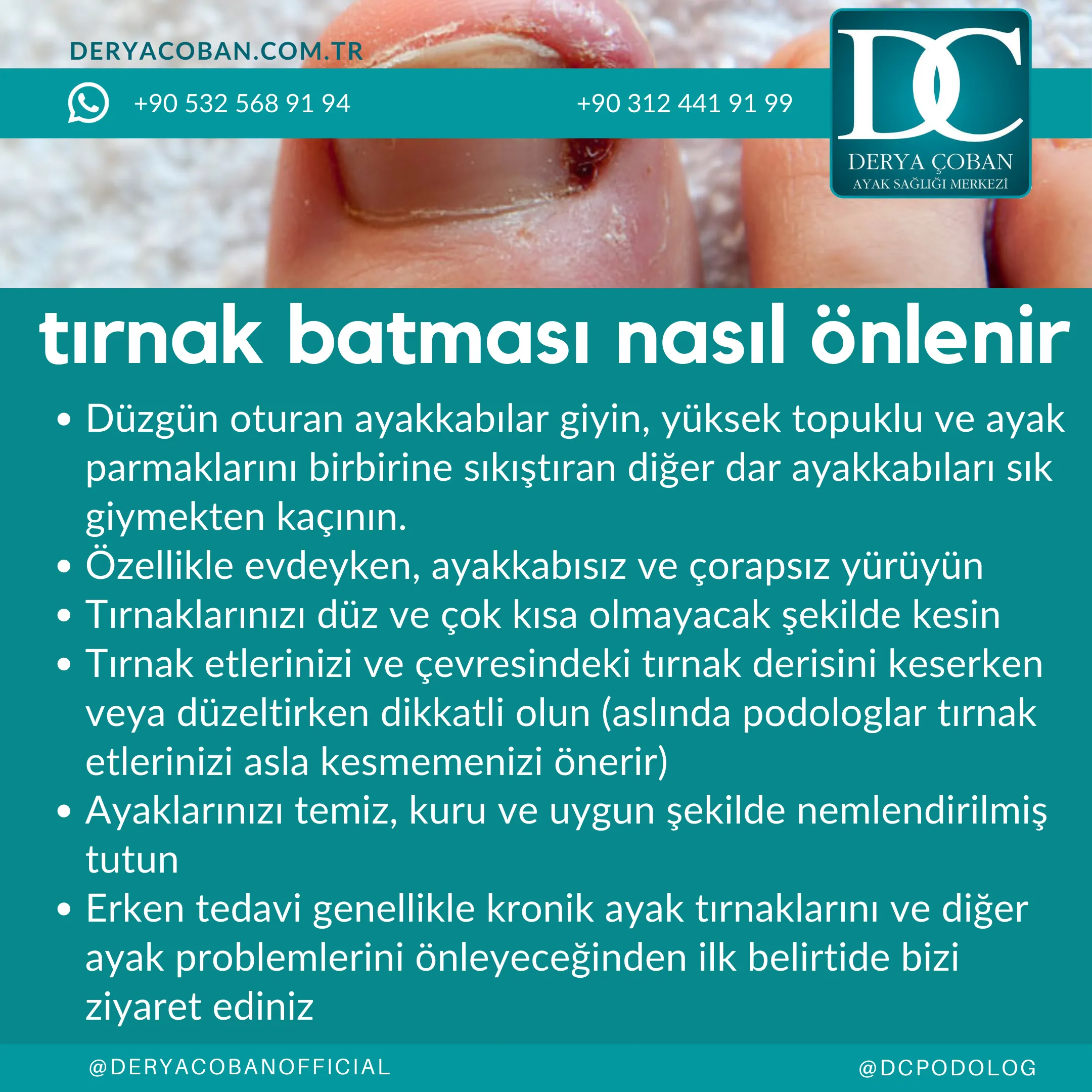 Evde Batık Tırnak Tedavisi