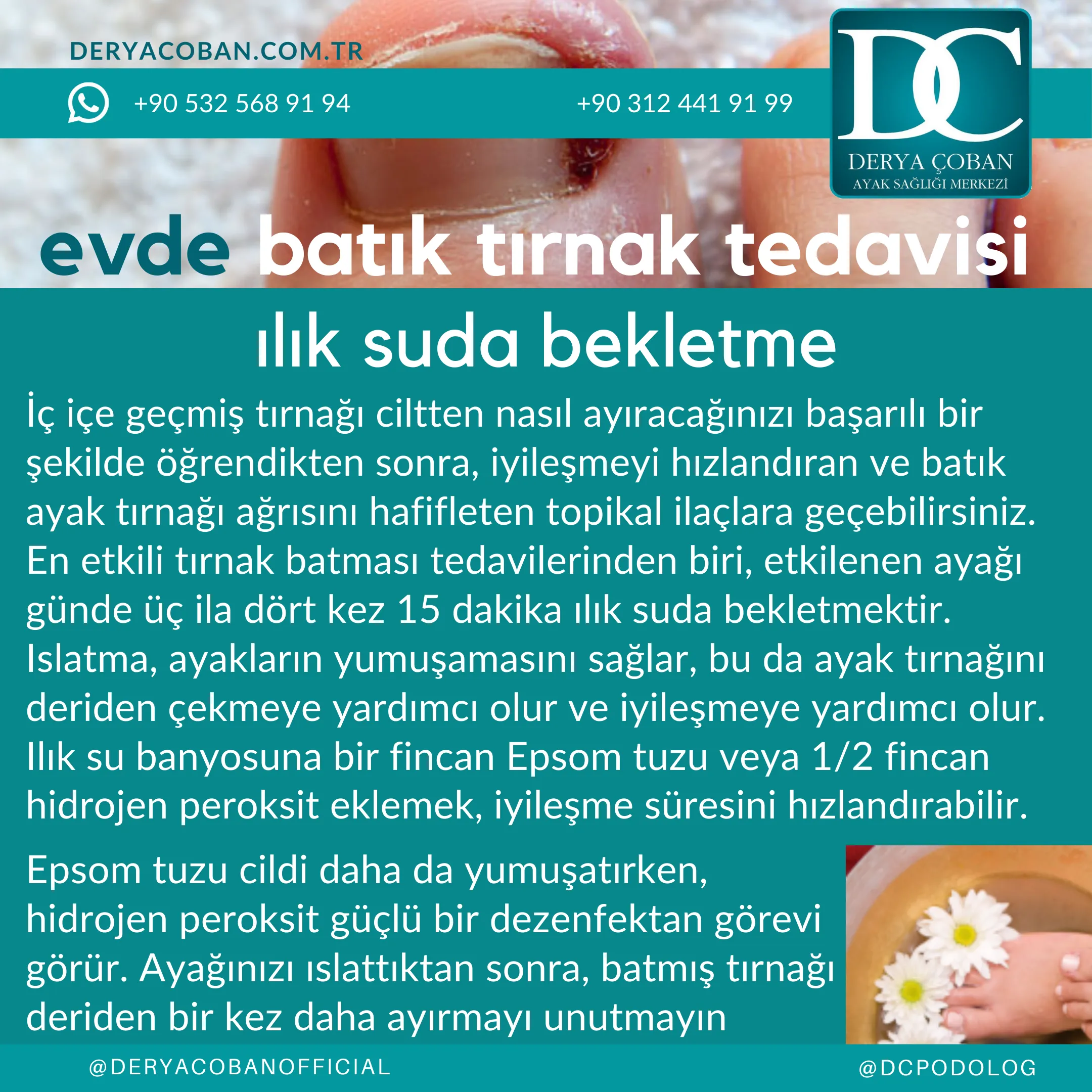 Evde Batık Tırnak Tedavisi