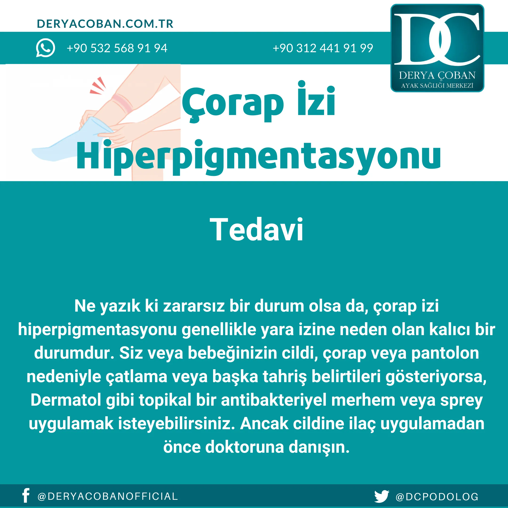 Çorap İzi Nasıl Geçer? Çorap İzi Hiperpigmentasyonu